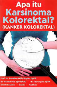 APA ITU KARSINOMA : KANKER KOLOREKTAL